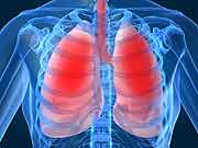 Combination Treatment for Cystic Fibrosis Shows Promise