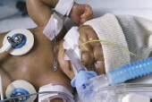 Study Finds Drop in Kids' Hospital-Related Infections