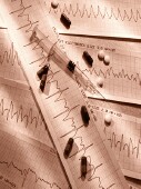 Could Too Much Medication for Irregular Heartbeat Raise Dementia Risk?