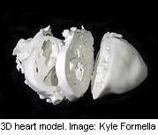 3-D Model of Heart May Help Surgeons Fix Defects