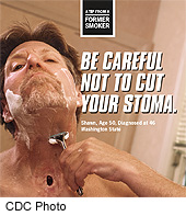 Anti-Smoking Campaign Successful and Cost-Effective, CDC Says