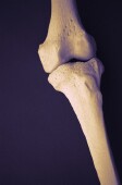 Statins Won't Help Protect Bones, Study Finds