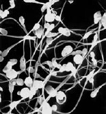 Poor Sperm Quality May Signal Health Issues, Study Finds