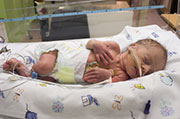 Some Tiny Preemies Show Poorer Mental Health in Adulthood