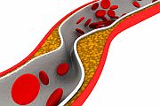 Newer Blood Thinner May Improve Outcomes for Heart Attack Survivors