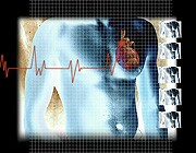 CT Scans Might Spot Heart Risks More Clearly in Patients With Chest Pain