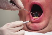 Treating Gum Disease Might Help Prostate Symptoms: Study
